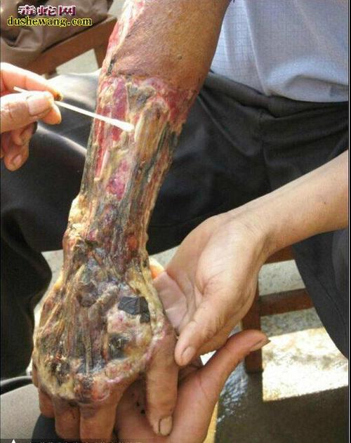 2025澳门开奖结果记录查询和男子在湖边被蛇咬伤与男子在湖边被蛇咬伤视频